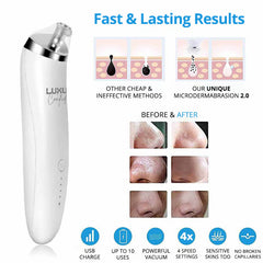 Aphrodite | Blackheads Treatment Kit 2.0